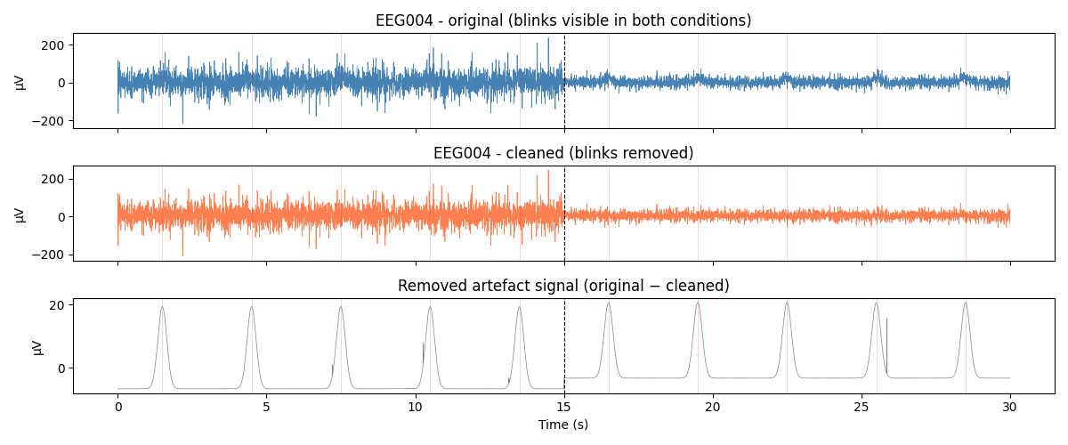EEG004 - original (blinks visible in both conditions), EEG004 - cleaned (blinks removed), Removed artefact signal (original − cleaned)